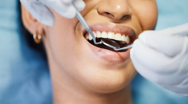 Best Broken or Cracked Tooth Emergency Dentist in Joshua Tree, CA